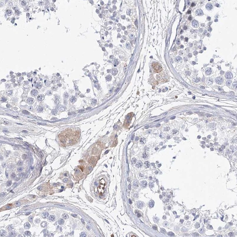 FAM208B Antibody - BSA Free Immunohistochemistry: FAM208B Antibody - BSA Free [NBP1-90803]
