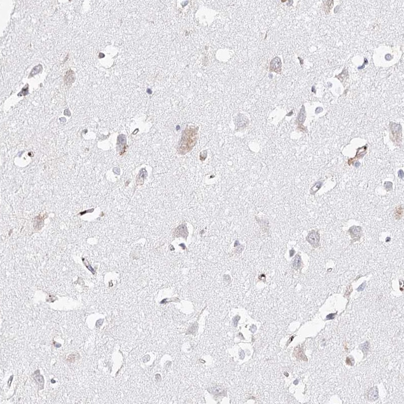 FAM208B Antibody - BSA Free Immunohistochemistry: FAM208B Antibody - BSA Free [NBP1-90803]