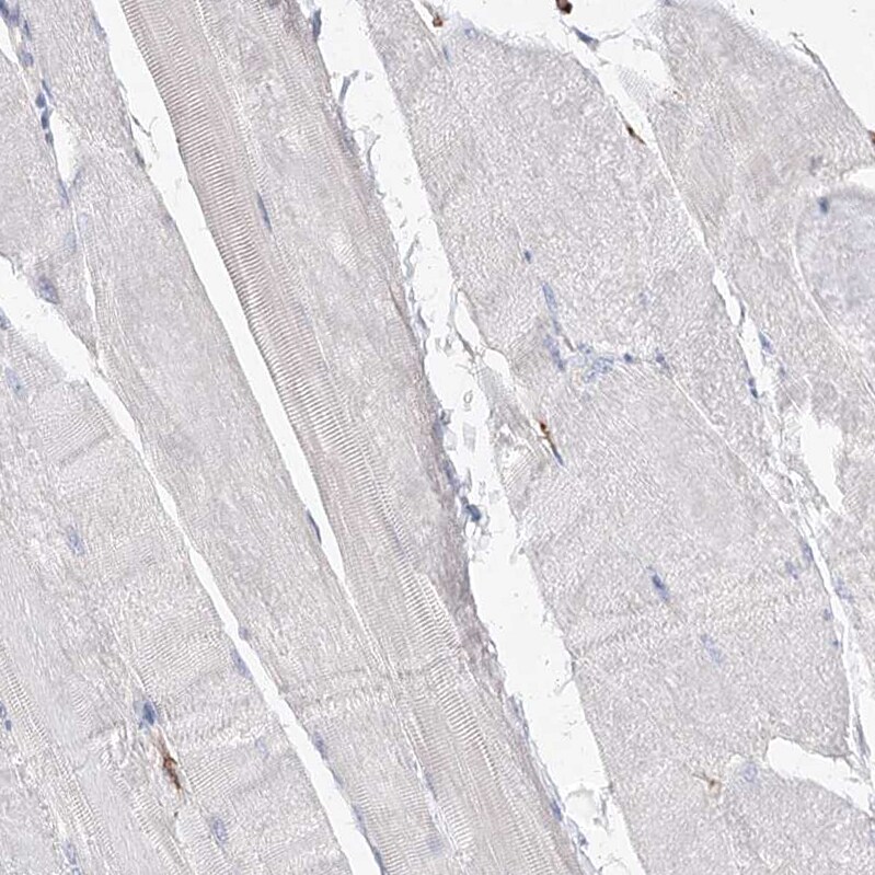 FAM208B Antibody - BSA Free Immunohistochemistry: FAM208B Antibody - BSA Free [NBP1-90803]