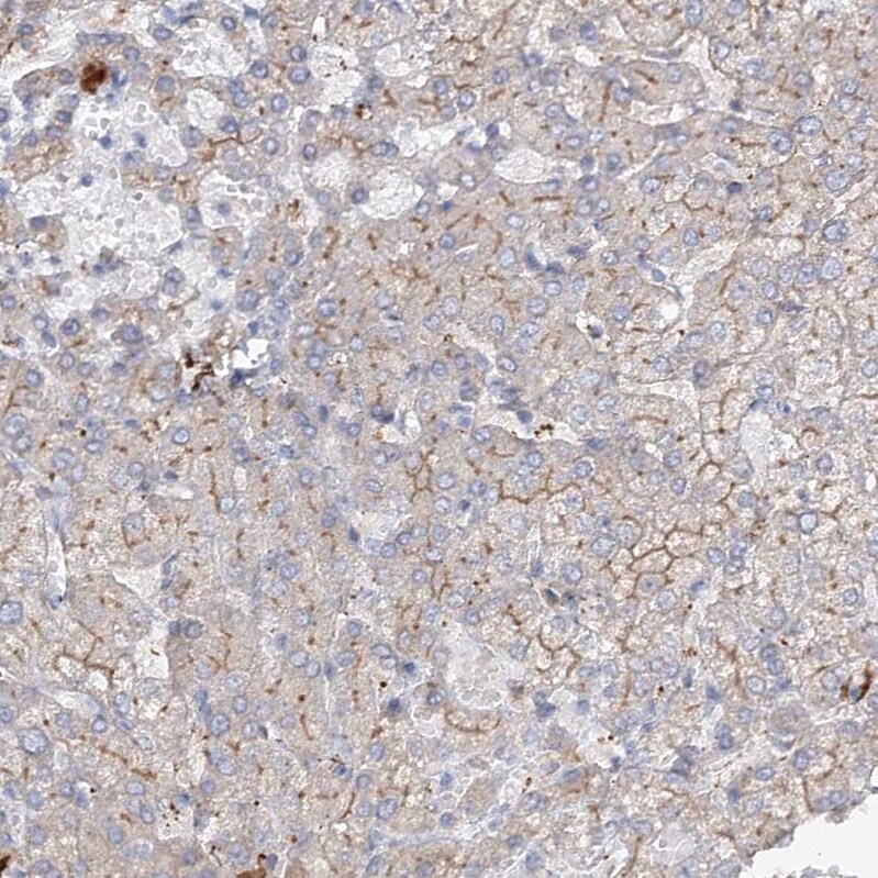 FAM208B Antibody - BSA Free Immunohistochemistry: FAM208B Antibody - BSA Free [NBP1-90803]