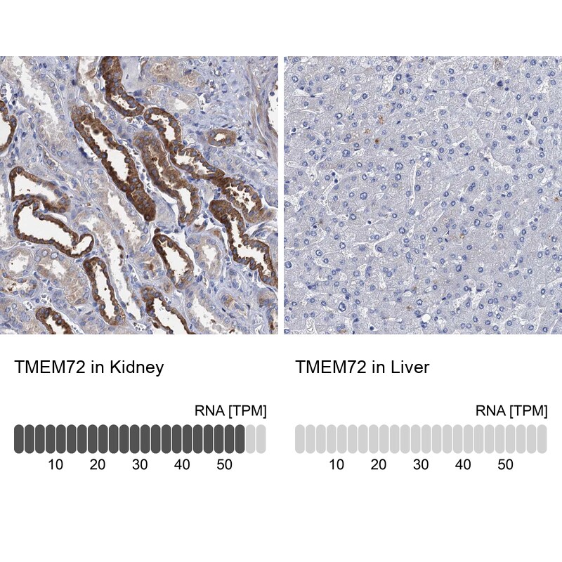 TMEM72 Antibody - BSA Free Immunohistochemistry-Paraffin: TMEM72 Antibody [NBP1-90808]