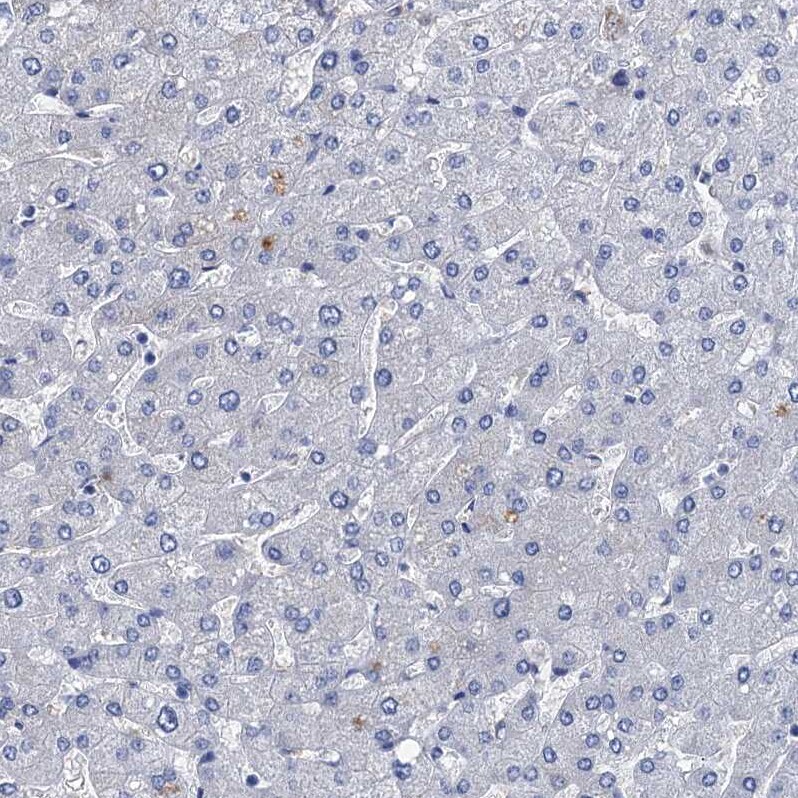 TMEM72 Antibody - BSA Free Immunohistochemistry-Paraffin: TMEM72 Antibody [NBP1-90808]