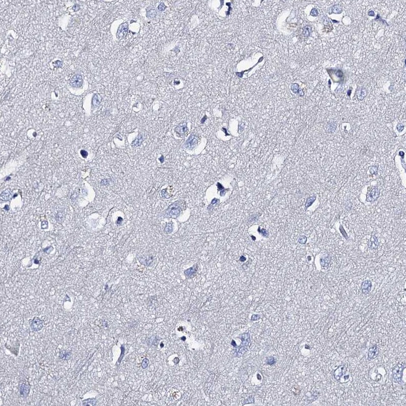 TMEM72 Antibody - BSA Free Immunohistochemistry-Paraffin: TMEM72 Antibody [NBP1-90808]