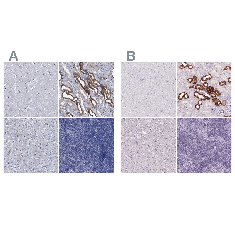 TMEM72 Antibody - BSA Free Immunohistochemistry-Paraffin: TMEM72 Antibody [NBP1-90808]