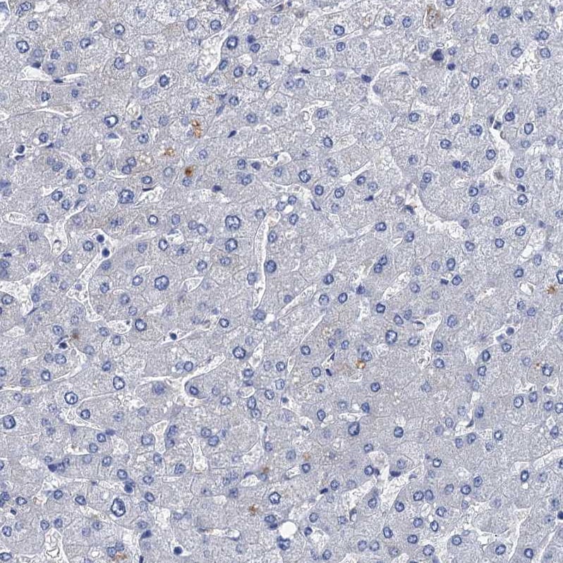 TMEM72 Antibody - BSA Free Immunohistochemistry: TMEM72 Antibody - BSA Free [NBP1-90808]