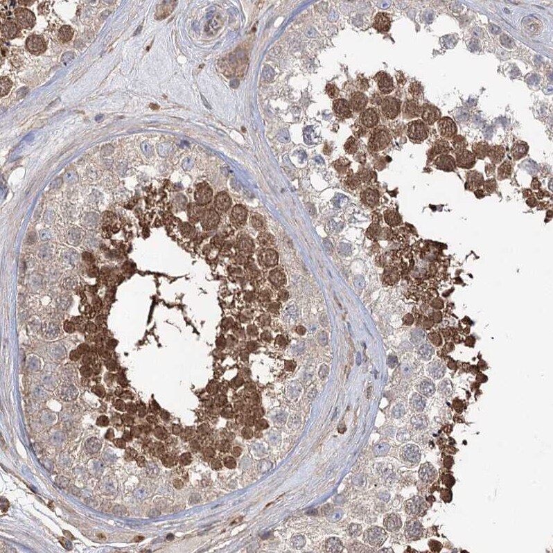 FAM13B1 Antibody - BSA Free Immunohistochemistry: FAM13B1 Antibody - BSA Free [NBP1-90810]
