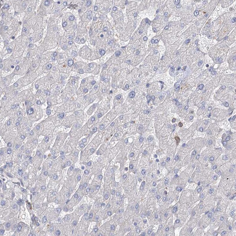 FAM13B1 Antibody - BSA Free Immunohistochemistry: FAM13B1 Antibody - BSA Free [NBP1-90810]