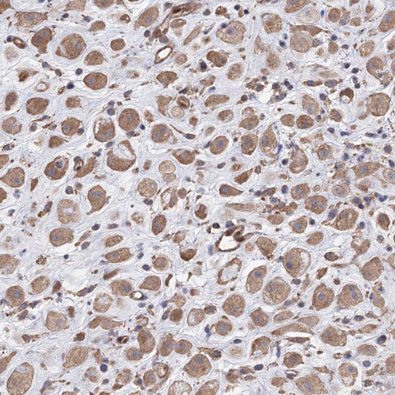 FAM13B1 Antibody - BSA Free Immunohistochemistry: FAM13B1 Antibody - BSA Free [NBP1-90810]