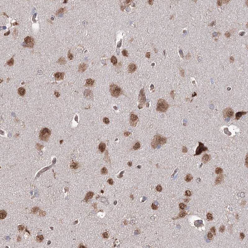 FAM13B1 Antibody - BSA Free Immunohistochemistry: FAM13B1 Antibody - BSA Free [NBP1-90810]