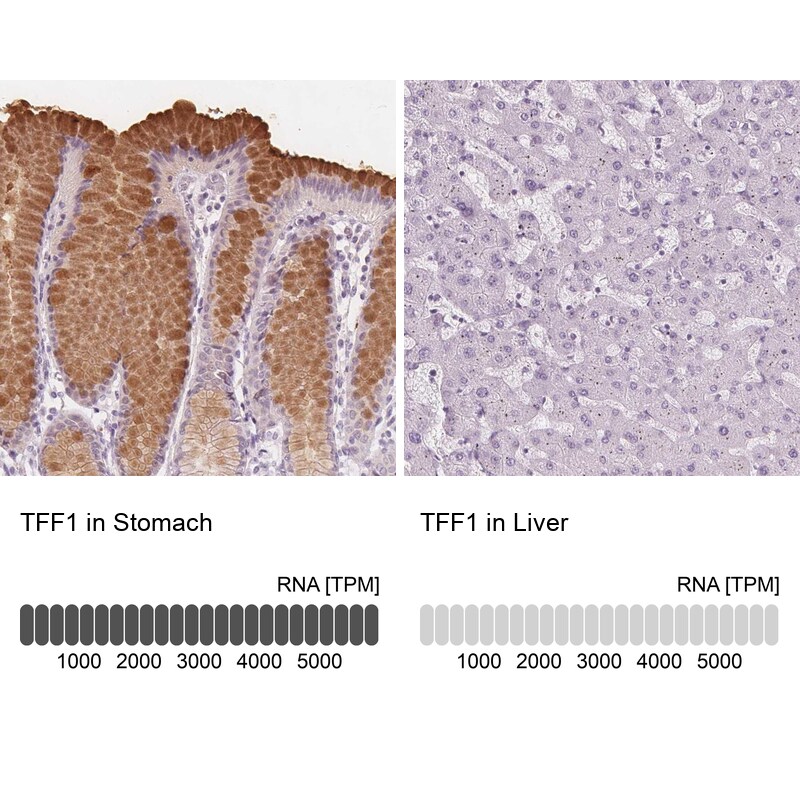 TFF1/pS2 Antibody - BSA Free Immunohistochemistry-Paraffin: TFF1/pS2 Antibody [NBP1-90813]