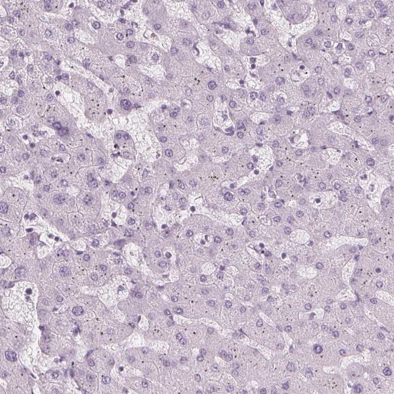 TFF1/pS2 Antibody - BSA Free Immunohistochemistry-Paraffin: TFF1/pS2 Antibody [NBP1-90813]