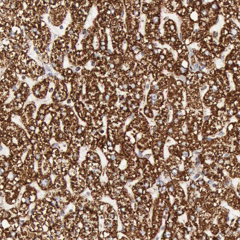 ATPB Antibody - BSA Free NBP1-90815: Novus Biologicals