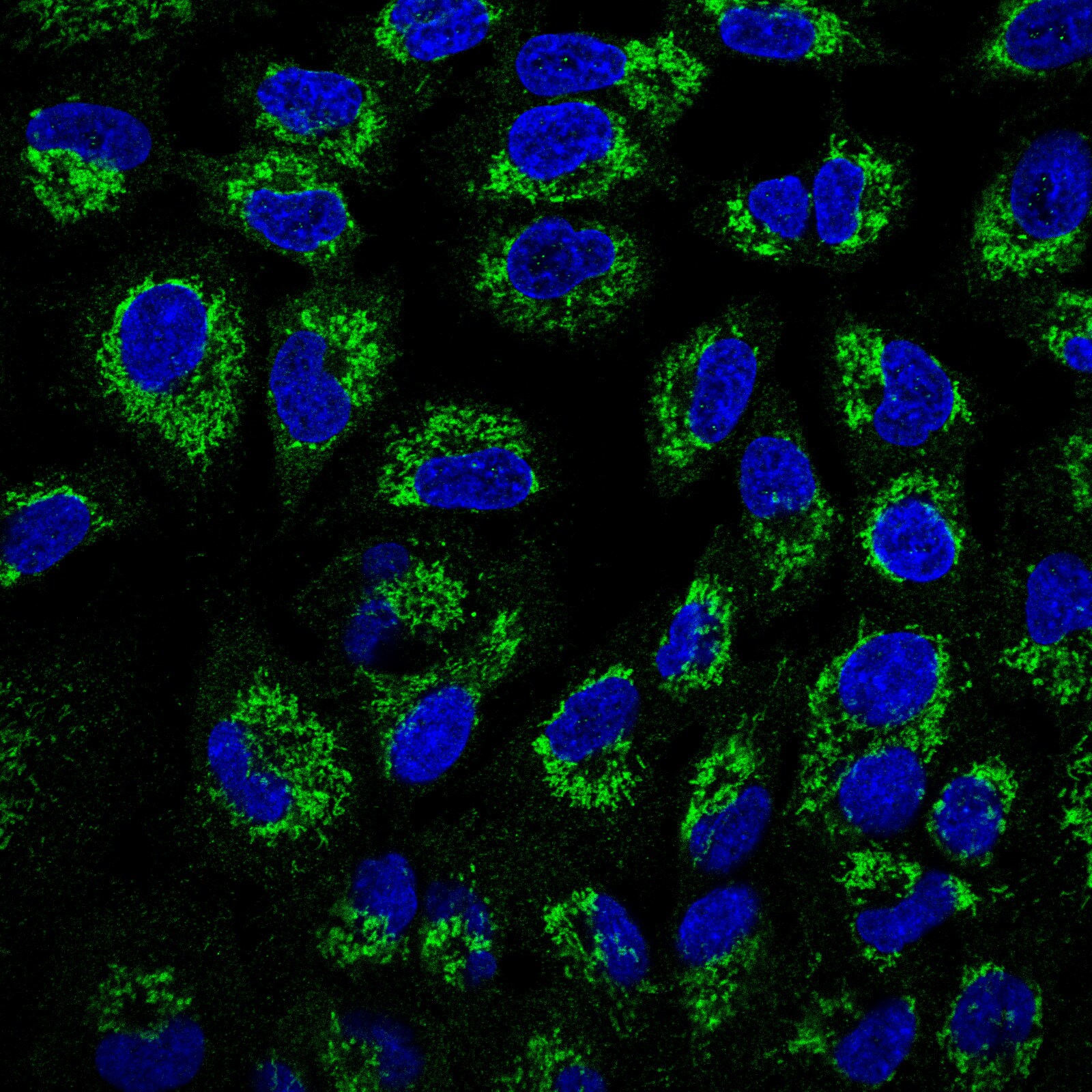 ATPB Antibody - BSA Free Immunocytochemistry/ Immunofluorescence: ATPB Antibody [NBP1-90816]