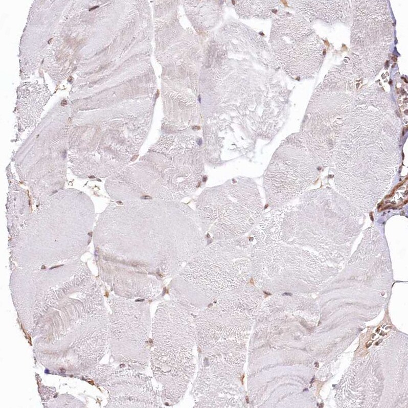 RBM27 Antibody - BSA Free Immunohistochemistry: RBM27 Antibody - BSA Free [NBP1-90818]