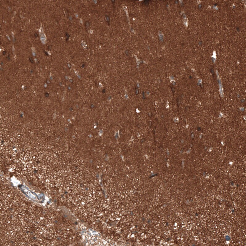 Renin R Antibody - BSA Free Immunohistochemistry: Renin R Antibody - BSA Free [NBP1-90820]