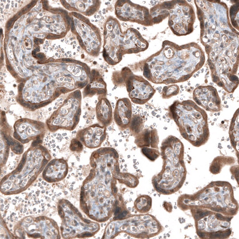 Renin R Antibody - BSA Free Immunohistochemistry: Renin R Antibody - BSA Free [NBP1-90820]