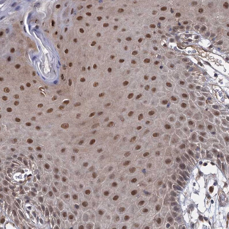 S5a/Angiocidin Antibody - BSA Free Immunohistochemistry: S5a/Angiocidin Antibody - BSA Free [NBP1-90821]