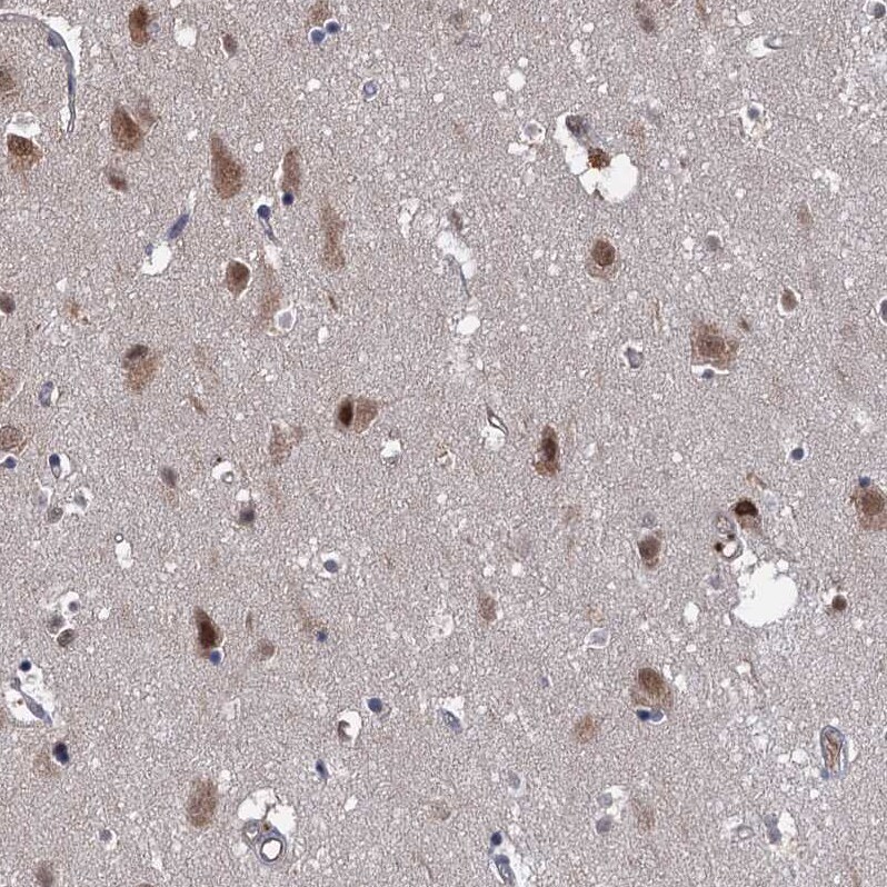 S5a/Angiocidin Antibody - BSA Free Immunohistochemistry: S5a/Angiocidin Antibody - BSA Free [NBP1-90821]