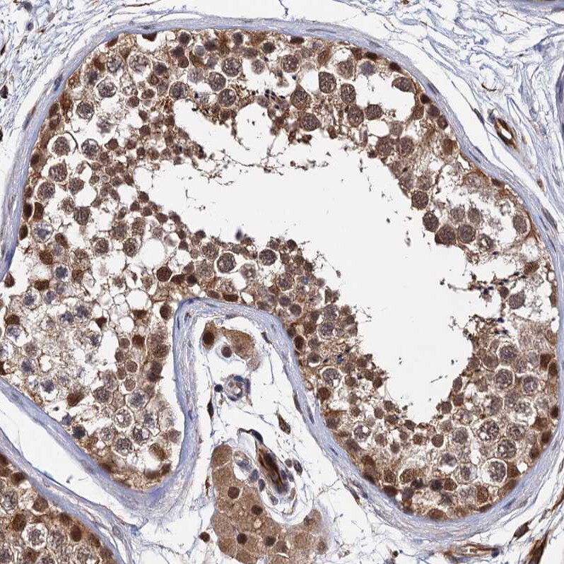 S5a/Angiocidin Antibody - BSA Free Immunohistochemistry: S5a/Angiocidin Antibody - BSA Free [NBP1-90821]