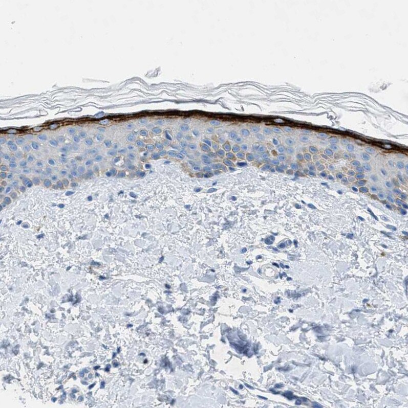 TMEM180 Antibody - BSA Free Immunohistochemistry: TMEM180 Antibody - BSA Free [NBP1-90827]