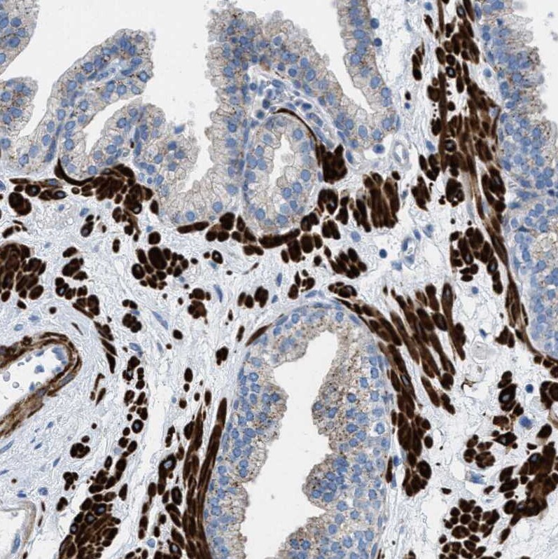 TMEM180 Antibody - BSA Free Immunohistochemistry: TMEM180 Antibody - BSA Free [NBP1-90827]