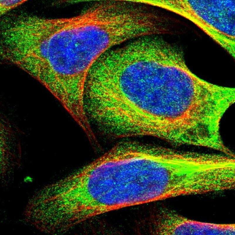 UBAP2 Antibody - BSA Free Immunocytochemistry/ Immunofluorescence: UBAP2 Antibody [NBP1-90829]
