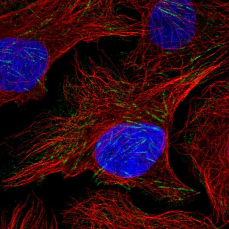 FRMD1 Antibody - BSA Free Immunocytochemistry/ Immunofluorescence: FRMD1 Antibody [NBP1-90832]