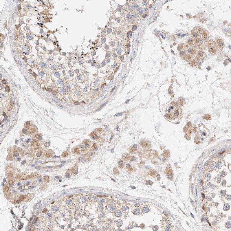 B3GNTL1 Antibody - BSA Free Immunohistochemistry: B3GNTL1 Antibody - BSA Free [NBP1-90838]