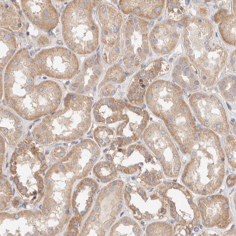B3GNTL1 Antibody - BSA Free Immunohistochemistry: B3GNTL1 Antibody - BSA Free [NBP1-90838]