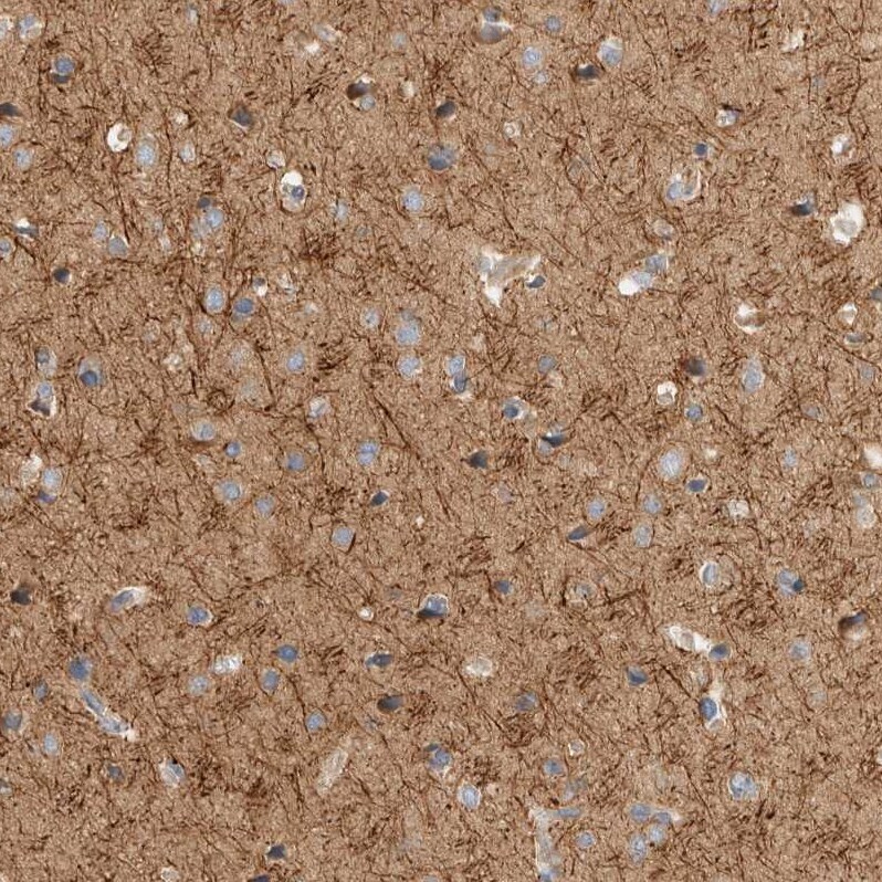 B3GNTL1 Antibody - BSA Free Immunohistochemistry: B3GNTL1 Antibody - BSA Free [NBP1-90838]