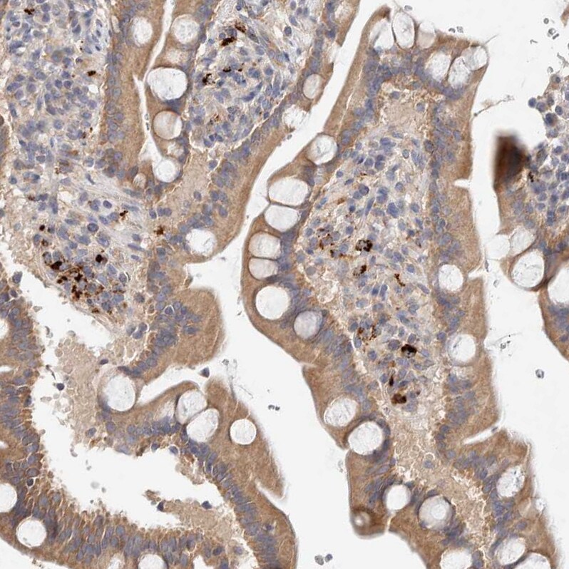 B3GNTL1 Antibody - BSA Free Immunohistochemistry: B3GNTL1 Antibody - BSA Free [NBP1-90838]