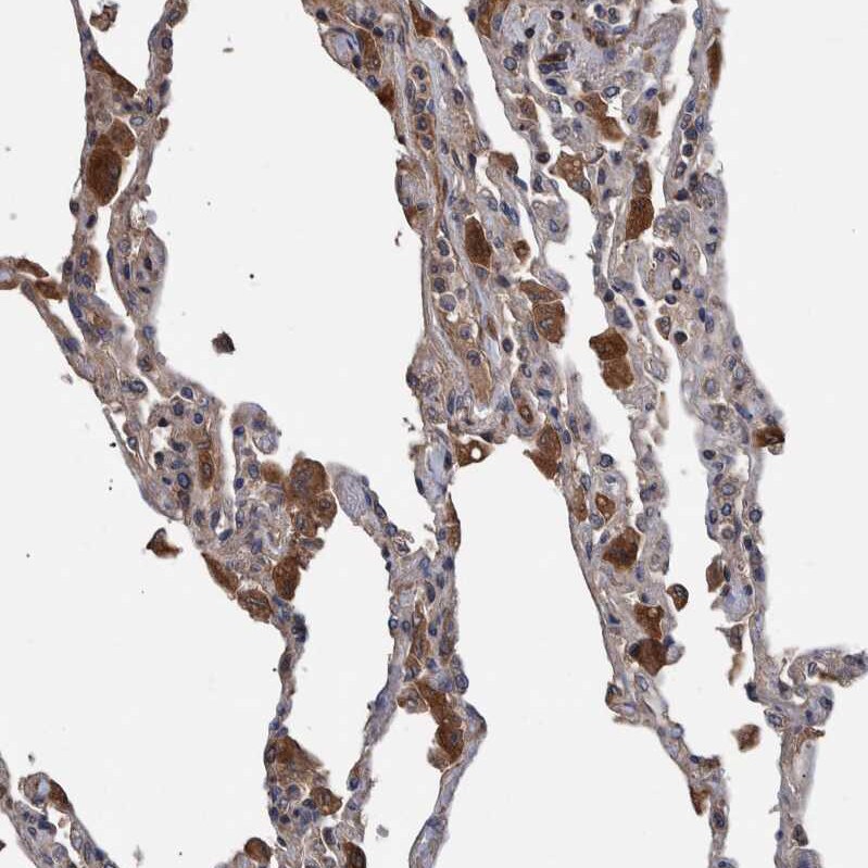 B3GNTL1 Antibody - BSA Free Immunohistochemistry: B3GNTL1 Antibody - BSA Free [NBP1-90839]