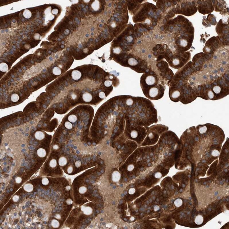 B3GNTL1 Antibody - BSA Free Immunohistochemistry: B3GNTL1 Antibody - BSA Free [NBP1-90839]