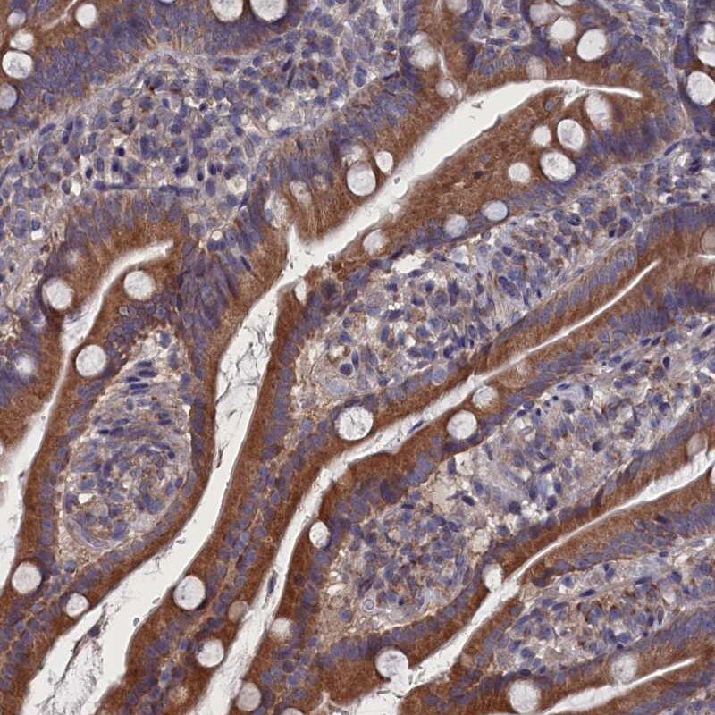 SPATA13 Antibody - BSA Free Immunohistochemistry-Paraffin: SPATA13 Antibody [NBP1-90849]