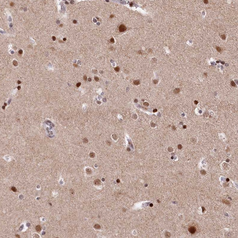 MCF2L2 Antibody - BSA Free Immunohistochemistry: MCF2L2 Antibody - BSA Free [NBP1-90851]