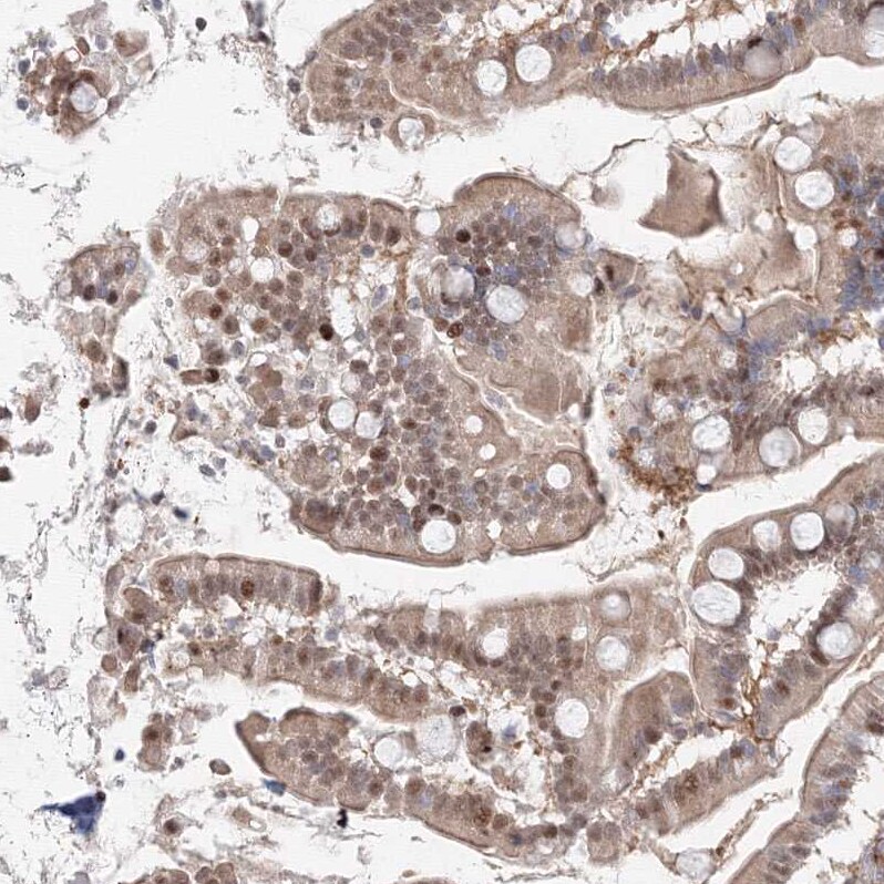 ARHGAP21 Antibody - BSA Free Immunohistochemistry: ARHGAP21 Antibody - BSA Free [NBP1-90852]