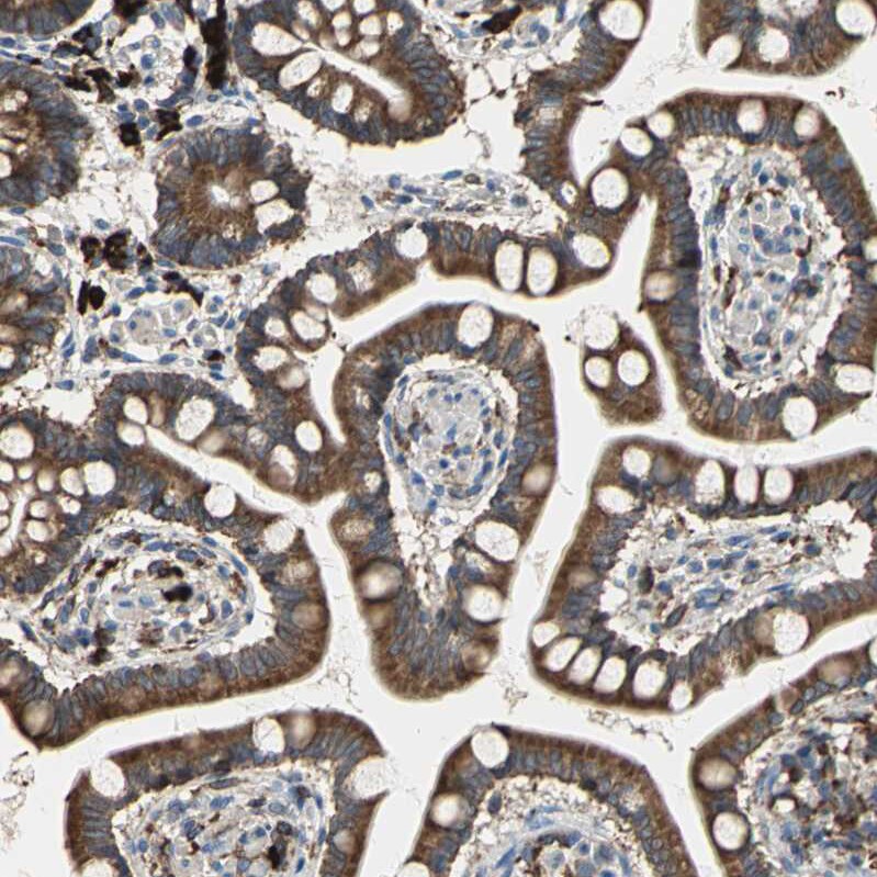 SDF2L1 Antibody - BSA Free Immunohistochemistry: SDF2L1 Antibody - BSA Free [NBP1-90854]