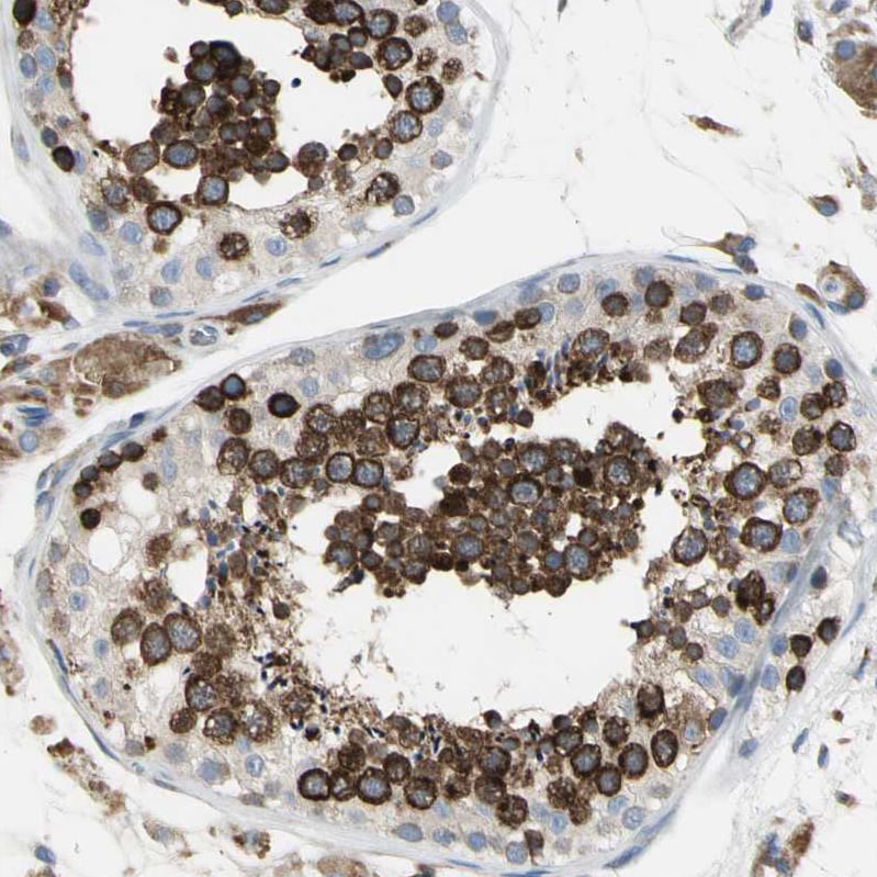 SDF2L1 Antibody - BSA Free Immunohistochemistry: SDF2L1 Antibody - BSA Free [NBP1-90854]