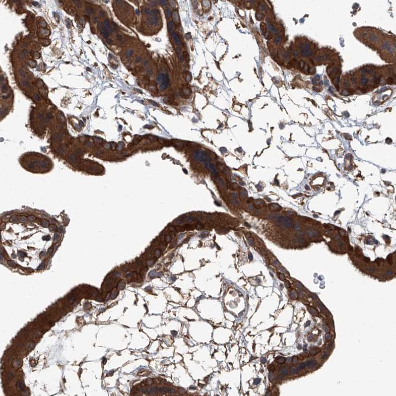 ANKRD34A Antibody - BSA Free Immunohistochemistry: ANKRD34A Antibody - BSA Free [NBP1-90856]