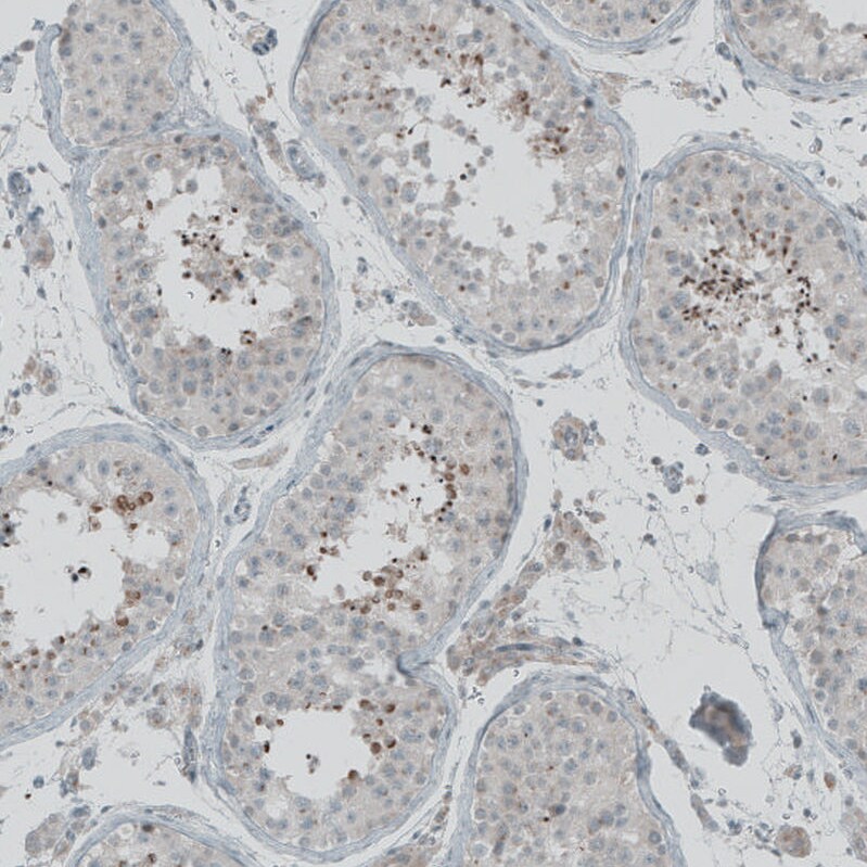 FBF1 Antibody - BSA Free Immunohistochemistry-Paraffin: FBF1 Antibody [NBP1-90863]
