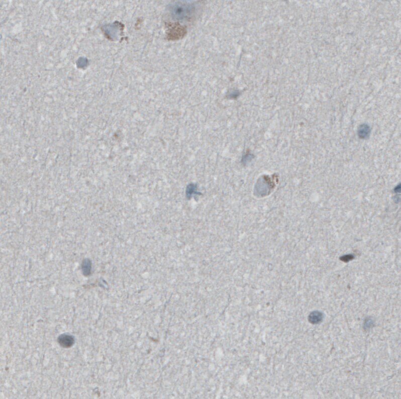 FBF1 Antibody - BSA Free Immunohistochemistry-Paraffin: FBF1 Antibody [NBP1-90863]