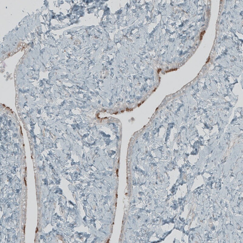FBF1 Antibody - BSA Free Immunohistochemistry-Paraffin: FBF1 Antibody [NBP1-90863]
