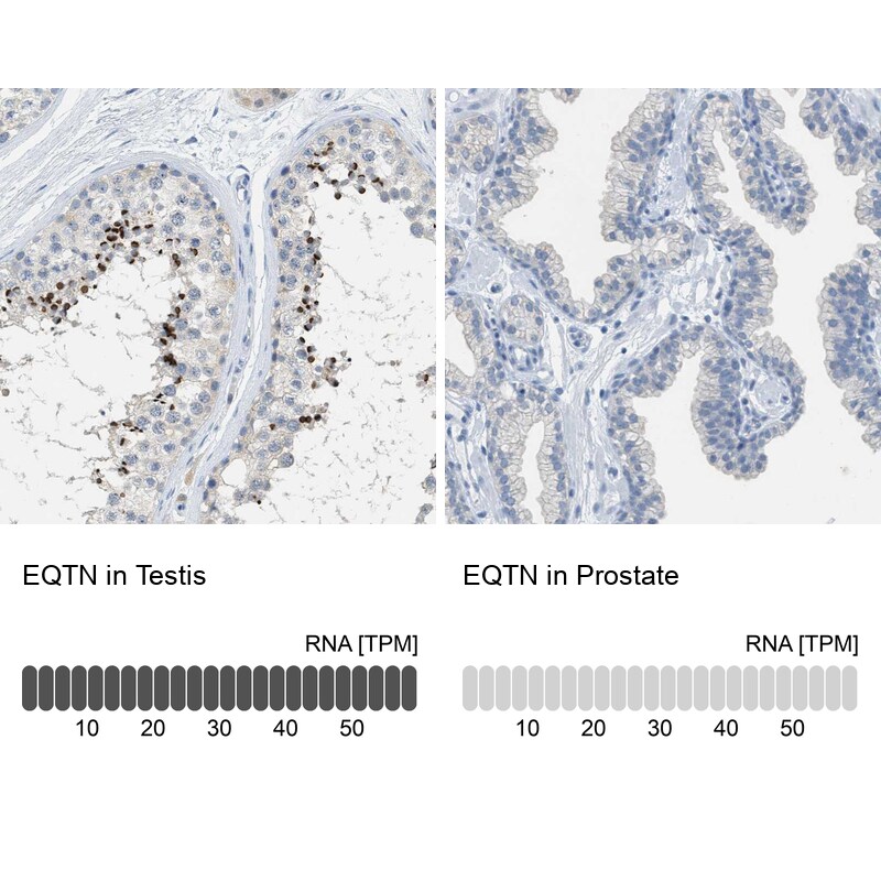 EQTN Antibody - BSA Free Immunohistochemistry-Paraffin: EQTN Antibody [NBP1-90869]