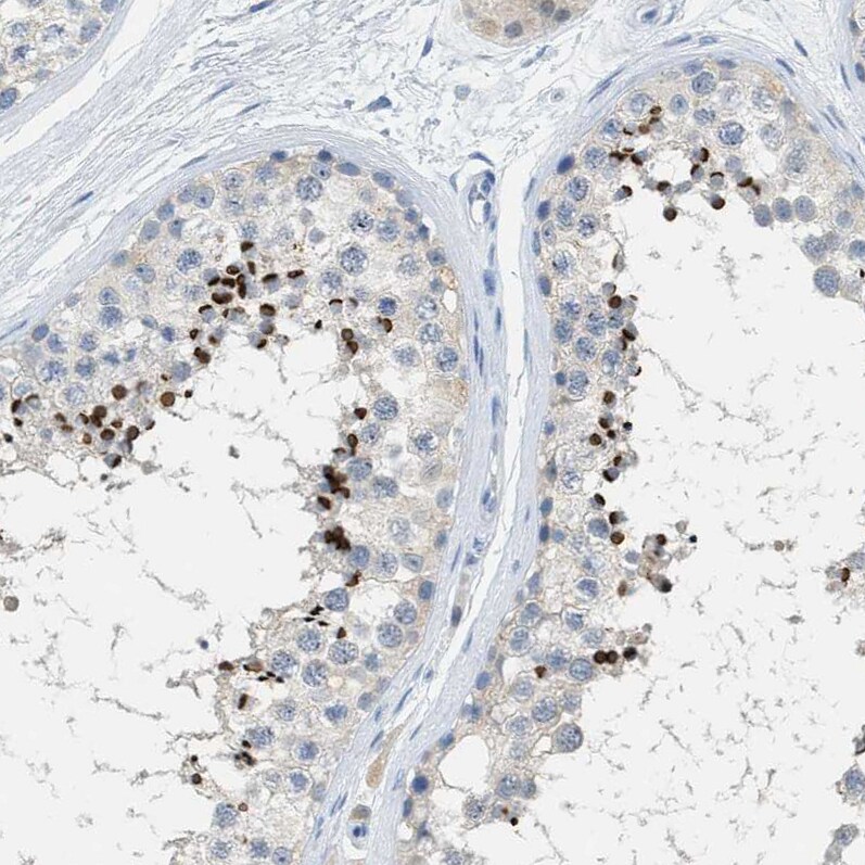 EQTN Antibody - BSA Free Immunohistochemistry-Paraffin: EQTN Antibody [NBP1-90869]