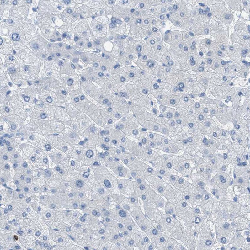 EQTN Antibody - BSA Free Immunohistochemistry-Paraffin: EQTN Antibody [NBP1-90869]