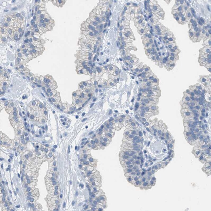 EQTN Antibody - BSA Free Immunohistochemistry-Paraffin: EQTN Antibody [NBP1-90869]
