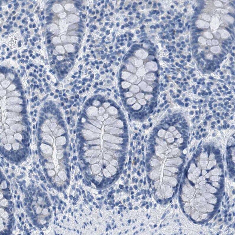 EQTN Antibody - BSA Free Immunohistochemistry-Paraffin: EQTN Antibody [NBP1-90869]