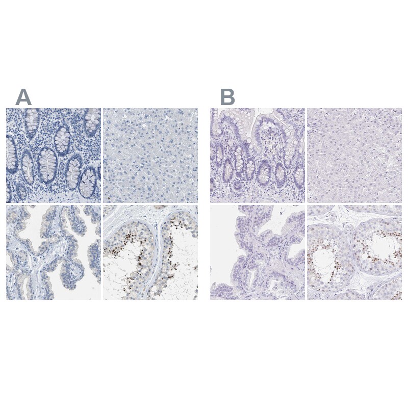 EQTN Antibody - BSA Free Immunohistochemistry-Paraffin: EQTN Antibody [NBP1-90869]
