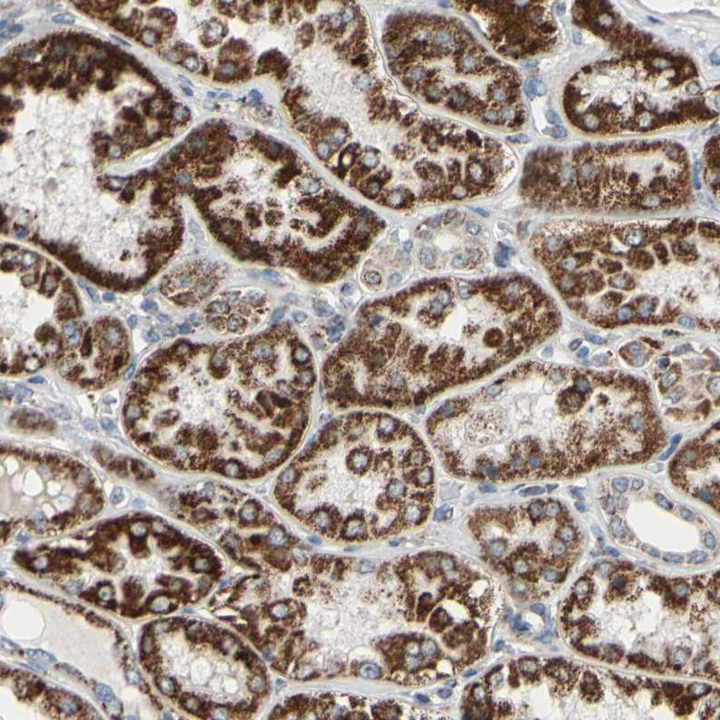 GLT8D1 Antibody - BSA Free Immunohistochemistry: GLT8D1 Antibody - BSA Free [NBP1-90872]