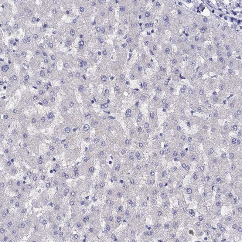 LRIT2 Antibody - BSA Free Immunohistochemistry-Paraffin: LRIT2 Antibody [NBP1-90876]